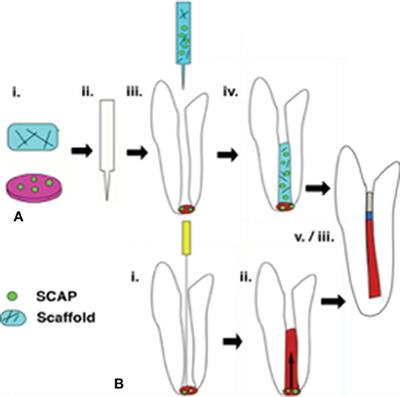 Biomaterials and Scaffold Design Strategies for Regenerative Endodontic Therapy